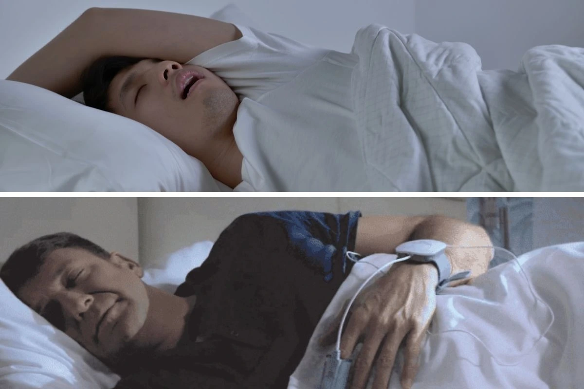 Top FAQs on Sleep Apnea: Find Restful Solutions